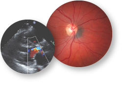 http://chronic-renal-insufficiency-cohort-study.org/Chronic-Kidney-Disease/Chronic-Renal-Insufficiency-Cohort-Study/uploads/images/photos/cric-bibliography.png